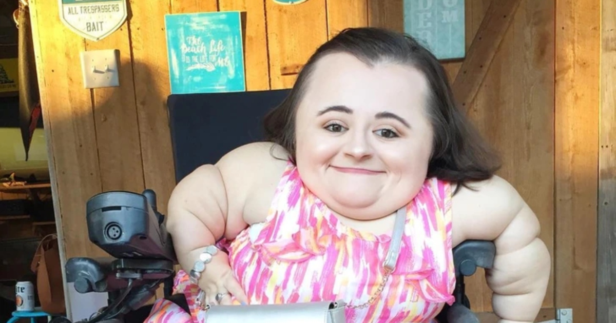 Girl with Rare Disease Becomes Beauty Influencer and Shows the World What People with Disabilities Can Achieve!