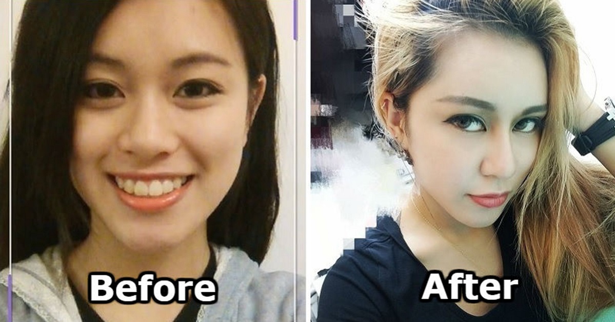 She Had 30 Plastic Surgeries For The Dumbest Reason