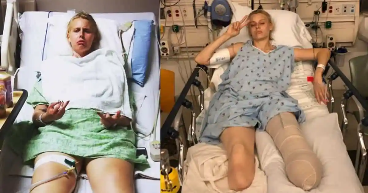 Her legs are amputated after using a common household product