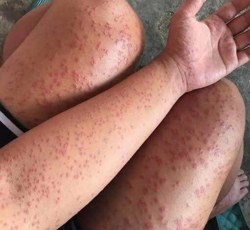 These are the consequences of sleeping with…