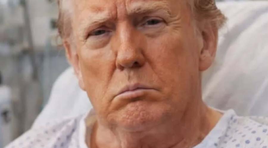 Trump’s Eyebrow Bruise Sparks Speculation About a Possible Fall