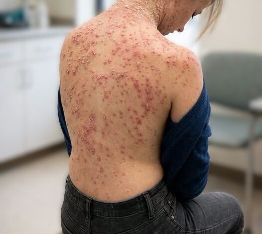 He Woke Up Covered in Bugs—And Nearly Didn’t Survive the Night