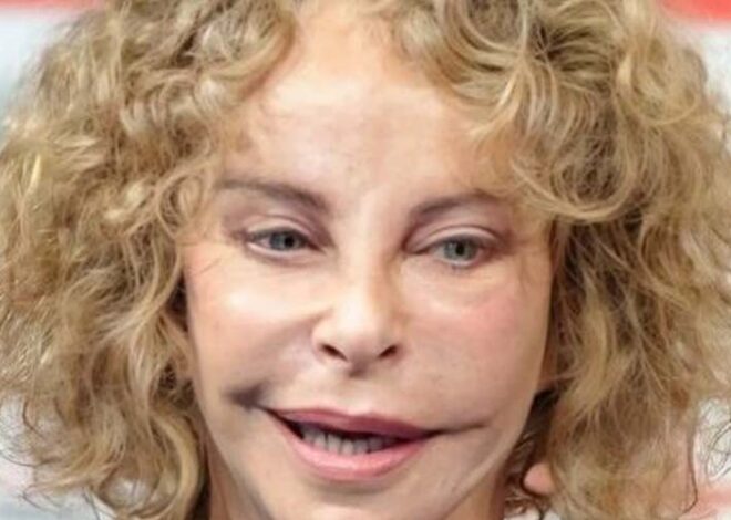 She was once a favorite of millions thanks to her unusual appearance, but has changed dramatically due to plastic surgery.