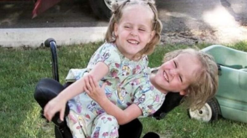 Search results for: Siamese twins separated at age 4 Now both sisters are 20 years old and this is what they look like