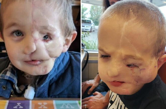 The story of five-year-old Ryder Wells