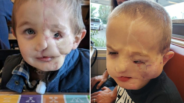 The story of five-year-old Ryder Wells