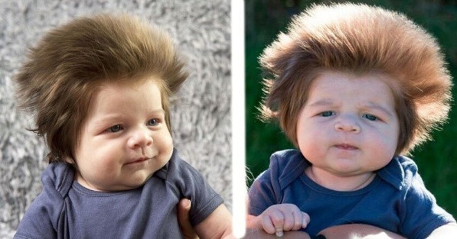 What does the baby who was born with luxurious hair look like now?