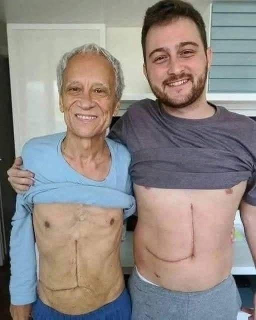 A Son’s Sacrifice: The Unseen Challenges of Living Liver Donation