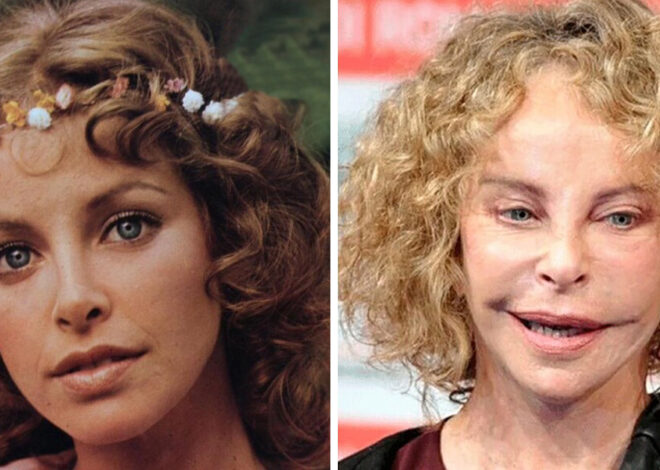 When the surgeon overdid it: 9 stars that are almost impossible to recognize after plastic surgery