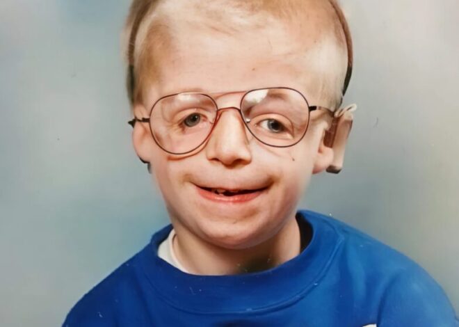 This Boy Was Born With An Unusual Appearance: Here’s What He Looks Like 40 Years Later