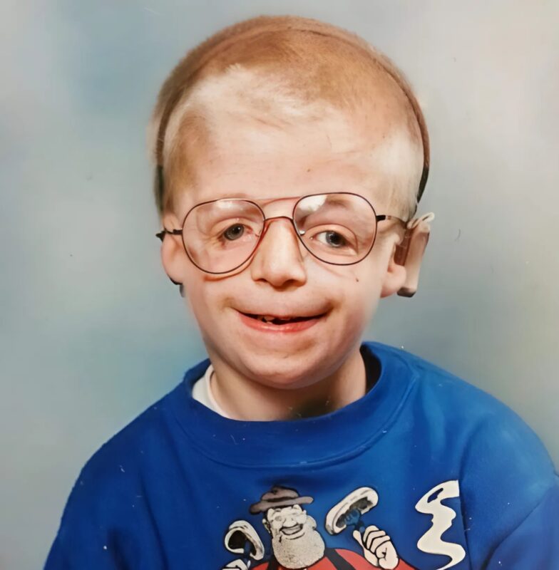 This Boy Was Born With An Unusual Appearance: Here’s What He Looks Like 40 Years Later
