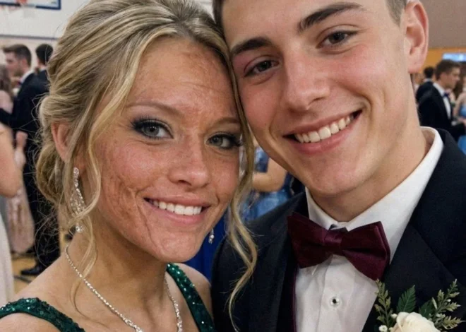 A Boy Asked Me to Dance at Prom Because No One Else Would Due to My Scars – The Next Day, His Parents and Officers Showed up at My Door