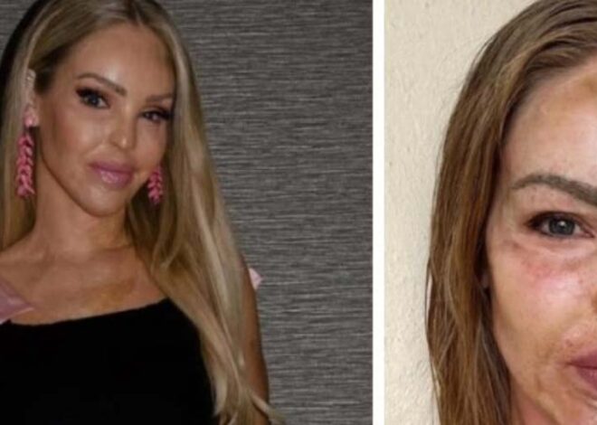 Katie Piper shares uplifting news 16 years after overcoming acid attack