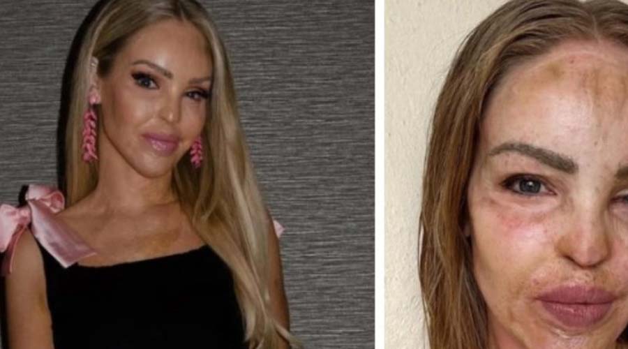 Katie Piper shares uplifting news 16 years after overcoming acid attack