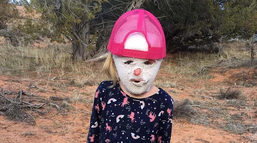 At Just 4, Her Life Changed Forever: Years Later, Her Transformation Is Touching Thousands