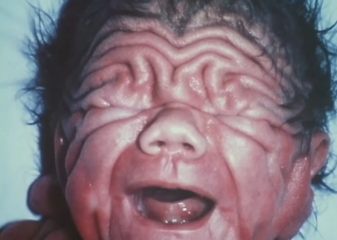The story of the baby that defied all odds.