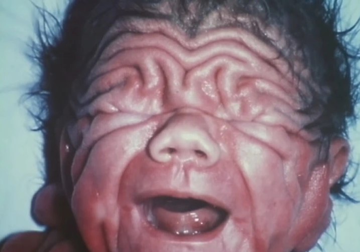 The story of the baby that defied all odds.