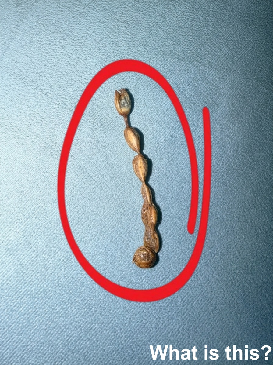 The Mystery in the Cushion Seam