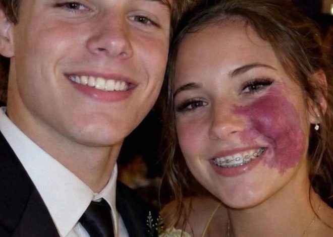 Only One Boy Asked Me to Prom Because No One Else Wanted to Due to the Birthmark on My Face – Everyone Laughed Until an Officer Walked Into the H