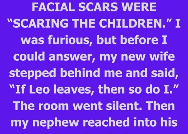My In-Laws Wanted My Scarred Nephew Removed From Our Wedding