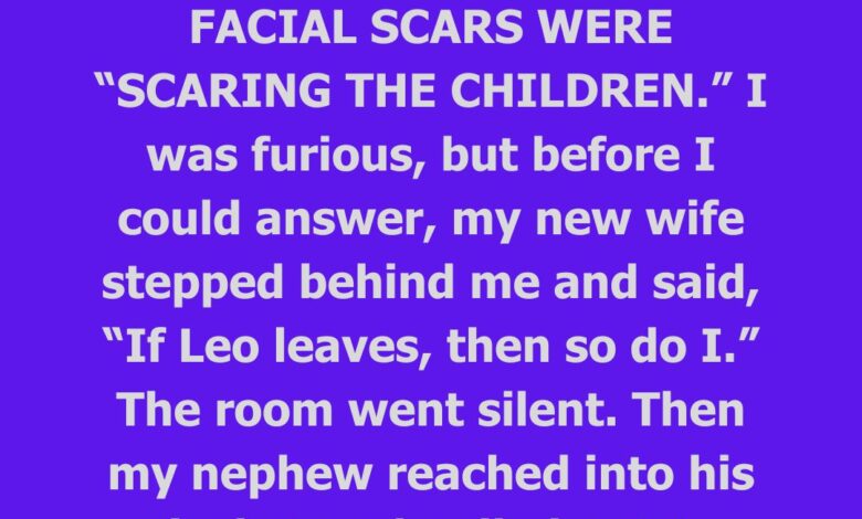 My In-Laws Wanted My Scarred Nephew Removed From Our Wedding