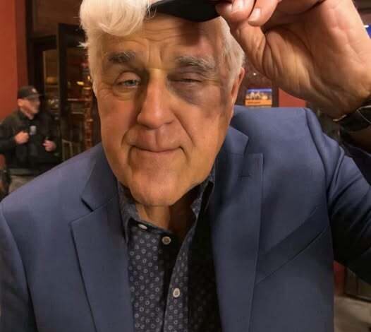Search results for: Jay Leno, 74, Opens Up About His Final Plans and the Legacy He Wants to Leave Behind