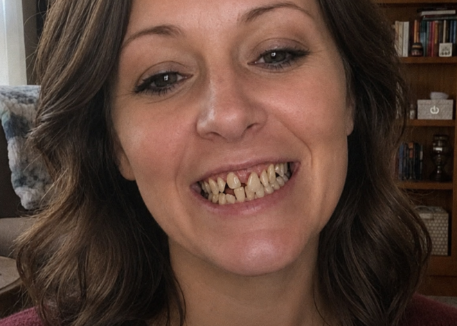 I Had Surgery to Fix My Teeth After Hiding My Smile for 25 Years – Then My Husband Refused to Let Me Attend His Family Dinner