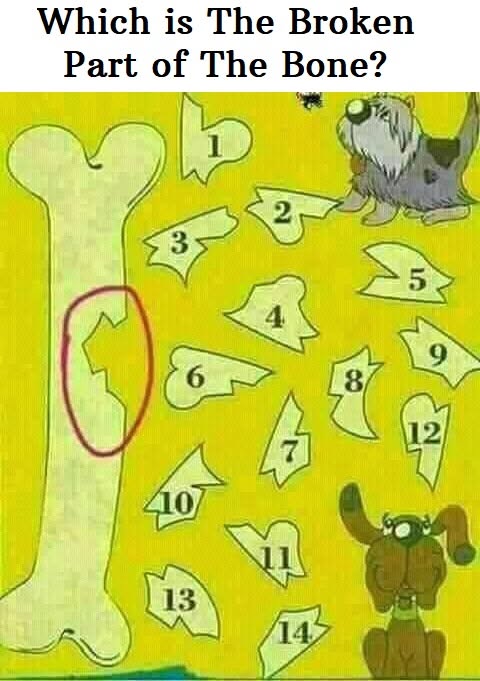 Which is The Broken Part of The Bone?