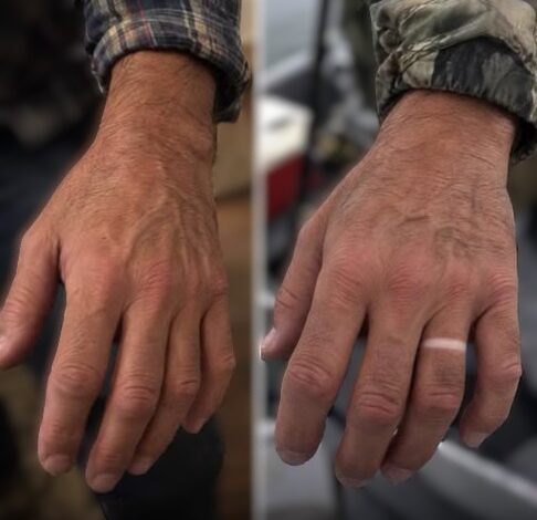 Man Returned from a Three-Day Fishing Trip with a Wedding Ring Mark – He Hadn’t Worn One in 12 Years