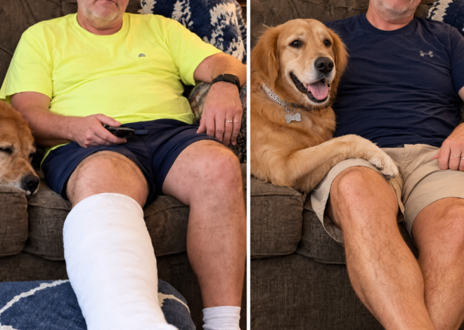 After 32 Years of Marriage, a Woman’s Husband Refused to Let Her Touch the Cast on His Right Leg – Then She Accidentally Saw What He Was Hiding Underneath It