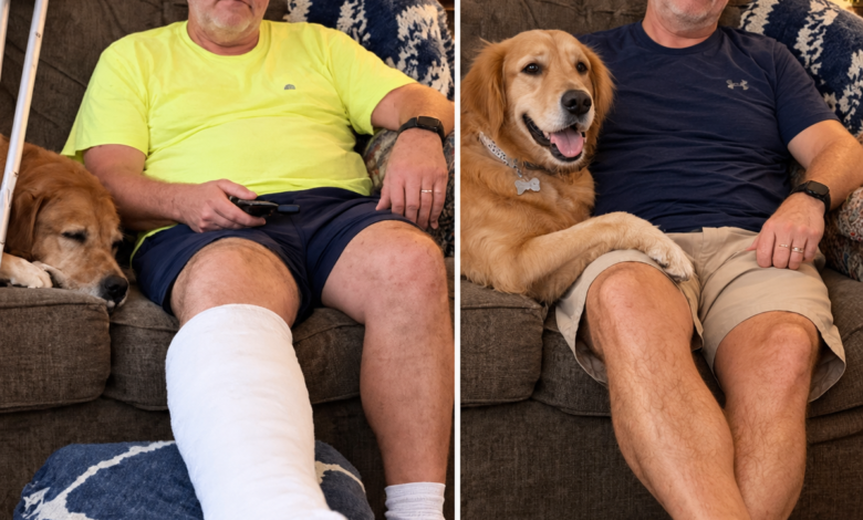 After 32 Years of Marriage, a Woman’s Husband Refused to Let Her Touch the Cast on His Right Leg – Then She Accidentally Saw What He Was Hiding Underneath It