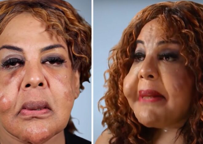 What “Cement Face” lady looks like 21 years later